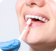 smile makeover